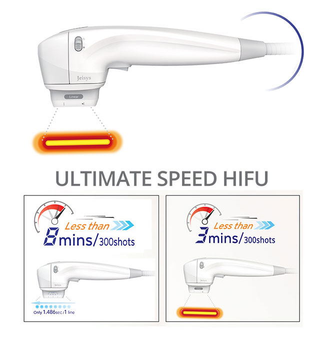 ultimate speed hifu HIFU Q plus