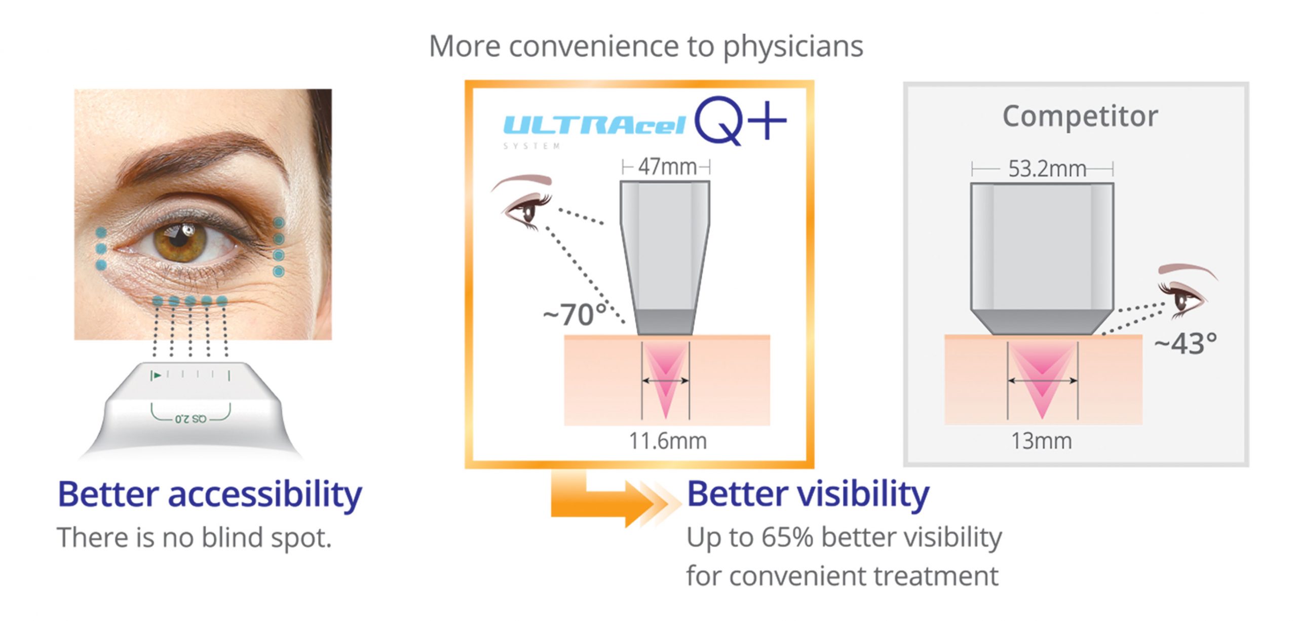 دسترسی بهتر برای درمان چروکهای دور چشم و نواحی منحنی